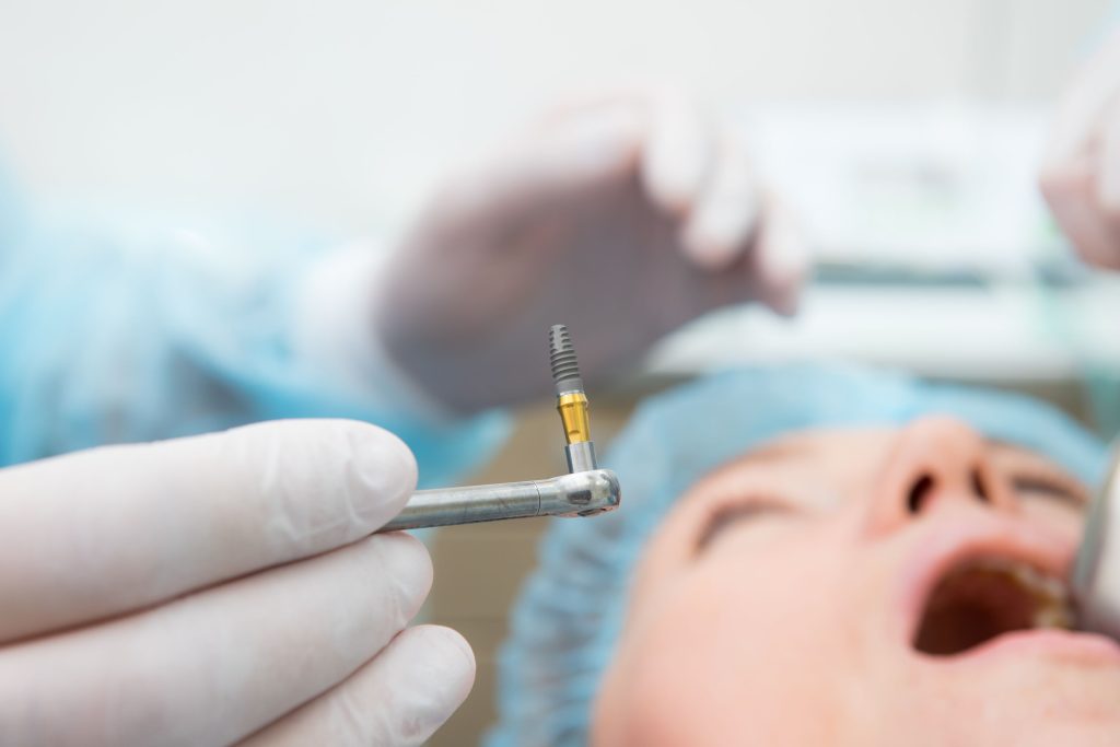 Dentist in blue surgery scrubs and white gloves holding implant with patient blurry in background